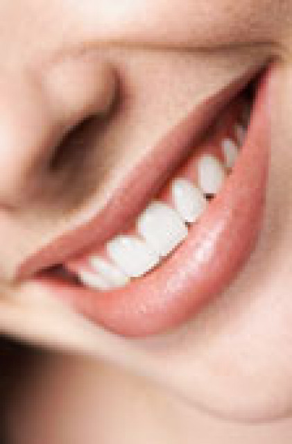 Non Prep Veneers-Hollywood Smile made in Germany  - Wellness Gesundheit - Erding